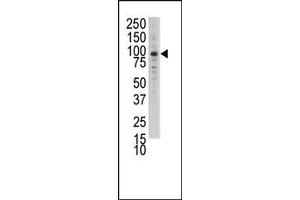 Image no. 1 for anti-Discoidin Domain Receptor tyrosine Kinase 1 (DDR1) (N-Term) antibody (ABIN359897) (DDR1 antibody  (N-Term))