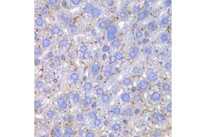 Immunohistochemistry of paraffin-embedded mouse liver using SPARC antibody at dilution of 1:100 (400x lens). (SPARC antibody)