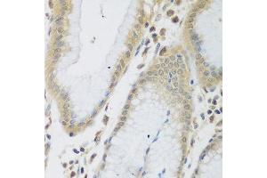 Immunohistochemistry of paraffin-embedded human stomach using ENPEP antibody at dilution of 1:200 (40x lens). (ENPEP antibody)