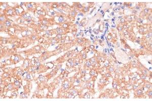 Immunohistochemistry of paraffin-embedded Rat liver using IKK alpha Polyclonal Antibody at dilution of 1:100 (40x lens). (IKK alpha antibody)