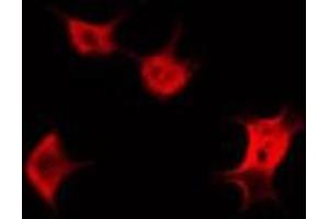 ABIN6266573 staining HeLa by IF/ICC. (KRT20 antibody  (C-Term))
