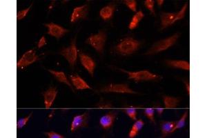 Immunofluorescence analysis of C6 cells using DNASE1L1 Polyclonal Antibody at dilution of 1:100. (DNASEX antibody)
