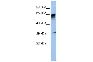 PRR18 antibody used at 1 ug/ml to detect target protein. (Proline Rich 18 antibody  (Middle Region))