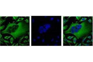 Western Blotting (WB) image for anti-Tubulin, beta (TUBB) antibody (ABIN3178583) (TUBB antibody)