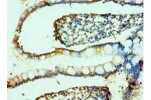 Immunohistochemistry of paraffin-embedded human small intestine tissue using ABIN7164791 at dilution of 1:100
