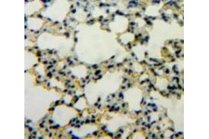 Used in DAB staining on fromalin fixed paraffin-embedded Lung tissue (IL1A antibody  (AA 116-270))