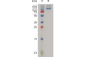 SDS-PAGE (SDS) image for Neuropilin 1 (NRP1) (AA 22-856) protein (His tag) (ABIN7491103)