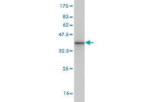 Western Blot detection against Immunogen (38. (ROPN1 antibody  (AA 1-120))