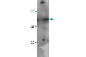 Jurkat cell lysates (40 ug) were resolved by SDS-PAGE, transferred to PVDF membrane and probed with PNMT monoclonal antibody, clone AT1C11  (1:500). (PNMT antibody  (AA 1-282))