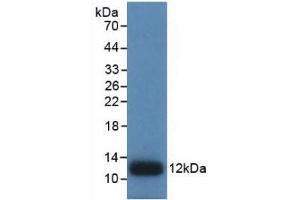 Detection of Recombinant IL8, Human using Monoclonal Antibody to Interleukin 8 (IL8) (IL-8 antibody  (AA 28-99))