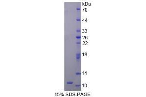 SDS-PAGE analysis of Human HOP Protein. (HOPX Protein)
