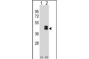 Western blot analysis of DUSP6 (arrow) using rabbit polyclonal DUSP6 Antibody (N-term) (ABIN1539487 and ABIN2849153). (DUSP6 antibody  (N-Term))