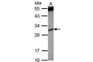 Image no. 2 for anti-Killer Cell Immunoglobulin-Like Receptor, Two Domains, Short Cytoplasmic Tail, 4 (KIR2DS4) (AA 1-294) antibody (ABIN1499052) (KIR2DS4 antibody  (AA 1-294))