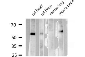 Western blot analysis of RUNX2 expression in various lysates (RUNX2 antibody  (Internal Region))