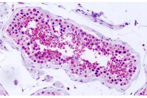 Anti-PRKD2 antibody IHC staining of human testis. (PKD2 antibody  (Internal Region))