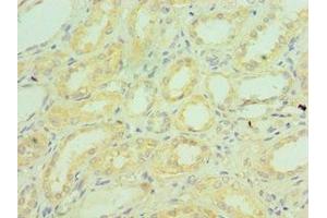 Immunohistochemistry of paraffin-embedded human kidney tissue using ABIN7148336 at dilution of 1:100 (C1QB antibody  (AA 104-253))