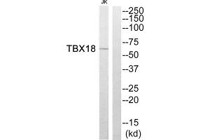 Western blot analysis of extracts from Jurkat cells, using TBX18 antibody.