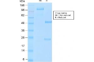 SDS-PAGE Analysis of Purified MUC16 Rabbit Recombinant Monoclonal Antibody (OCA125/2349R). (Recombinant MUC16 antibody)
