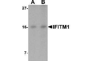 Western blot analysis of IFITM1 in Jurkat cell lysate with IFITM1 antibody at (A) 2. (IFITM1 antibody  (C-Term))