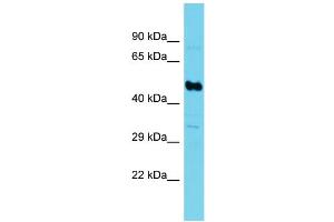 Western Blotting (WB) image for anti-Succinate-CoA Ligase, GDP-Forming, beta Subunit (SUCLG2) (N-Term) antibody (ABIN2790591) (SUCLG2 antibody  (N-Term))