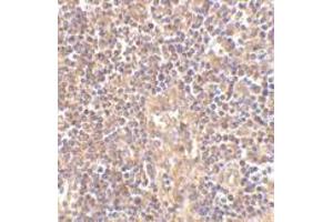 Immunohistochemistry of ATM in human lymph node tissue with this product atM antibody at 2. (ATM antibody  (C-Term))