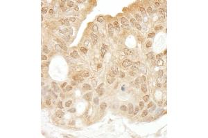 Immunohistochemistry (IHC) image for anti-Spleen tyrosine Kinase (SYK) (AA 250-300) antibody (ABIN7454368)