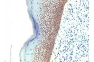 Formalin-fixed, paraffin-embedded human skin stained with E-Cadherin antibody (CDH1/1525). (E-cadherin antibody)