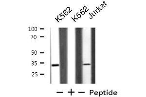 Western blot analysis of extracts from K562/Jurkat cells, using BTLA antibody. (BTLA antibody  (C-Term))