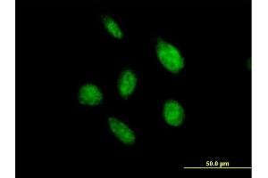 Immunofluorescence of purified MaxPab antibody to OVOL2 on HeLa cell.