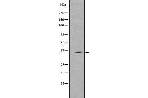 Western blot analysis of PPT1 using Jurkat whole  lysates. (PPT1 antibody  (Internal Region))