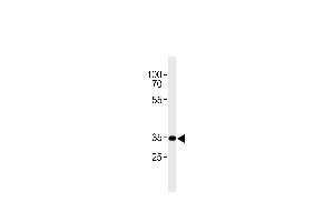 CNR2 antibody  (C-Term)