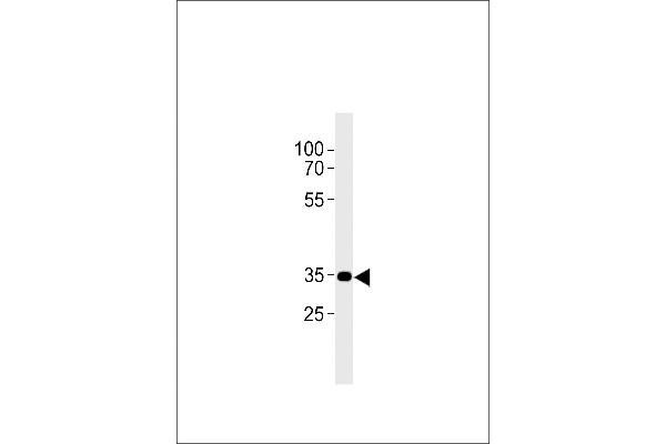 CNR2 antibody  (C-Term)
