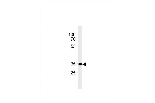 CNR2 antibody  (C-Term)