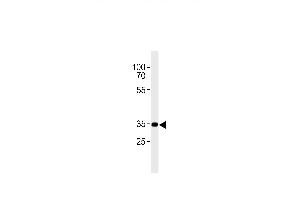 CB2 Antibody (C-term) (ABIN654631 and ABIN2844327) western blot analysis in A431 cell line lysates (35 μg/lane). (CNR2 antibody  (C-Term))