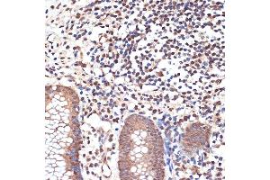 Immunohistochemistry of paraffin-embedded human appendix using K/MYST1/MOF Rabbit mAb (ABIN7268063) at dilution of 1:100 (40x lens). (MYST1 antibody)