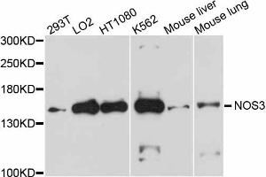 Western blot analysis of extracts of various cell lines, using NOS3 antibody (ABIN5970734) at 1/1000 dilution. (ENOS antibody)