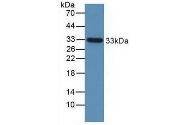 IGFBP2 antibody  (AA 148-325)