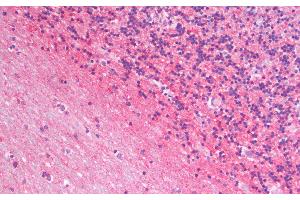 Immunohistochemistry analysis of paraffin-embedded Human Cerebellum using GAP43 Polyclonal Antibody. (GAP43 antibody)