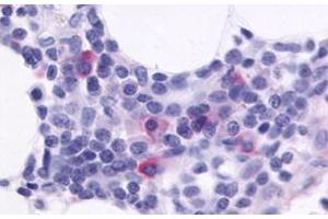 Immunohistochemical staining of human spleen with CXCR5 polyclonal antibody . (CXCR5 antibody  (C-Term))