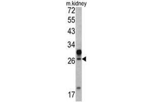 Western blot analysis of HOXA5 antibody (C-term E211) in mouse kidney tissue lysates (35ug/lane). (HOXA5 antibody  (C-Term))