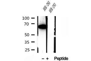 Western blot analysis of extracts of HEK-293 cells, using METTL3 antibody. (METTL3 antibody)