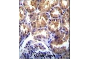 TR(CHAK2) Antibody (Center) (ABIN392616 and ABIN2842133) immunohistochemistry analysis in formalin fixed and paraffin embedded human kidney tissue followed by peroxidase conjugation of the secondary antibody and DAB staining. (TRPM6 antibody  (AA 317-348))
