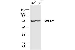 ZNF671 antibody  (AA 101-200)