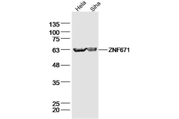 ZNF671 抗体  (AA 101-200)
