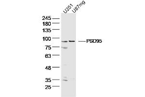 Lane 1: U251 lysates Lane 2: U87mg lysates probed with DLG4 Polyclonal Antibody, Unconjugated  at 1:300 dilution and 4˚C overnight incubation. (DLG4 antibody  (AA 351-450))
