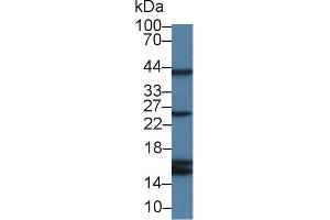 Detection of CYPA in Rat Serum using Polyclonal Antibody to Cyclophilin A (CYPA) (PPIA antibody  (AA 2-165))