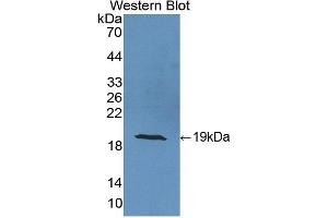 Detection of Recombinant CRABP2, Human using Polyclonal Antibody to Cellular Retinoic Acid Binding Protein 2 (CRABP2) (CRABP2 antibody  (AA 1-138))