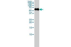 SF3A3 monoclonal antibody (M01A), clone 2E9-2B7 Western Blot analysis of SF3A3 expression in A-431 . (SF3A3 antibody  (AA 1-501))