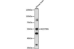Western blot analysis of extracts of various cell lines, using NOSTRIN antibody (ABIN7268922) at 1:1000 dilution. (NOSTRIN antibody  (AA 207-506))