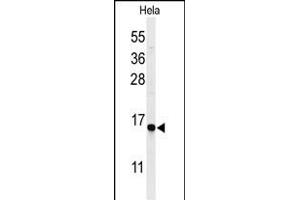 Western blot analysis of GABARL1 Antibody 9133a in Hela cell line lysates (35 μg/lane). (GABARAPL1 antibody)